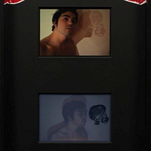 le signe vertébrale sécable - Francis Coffinet